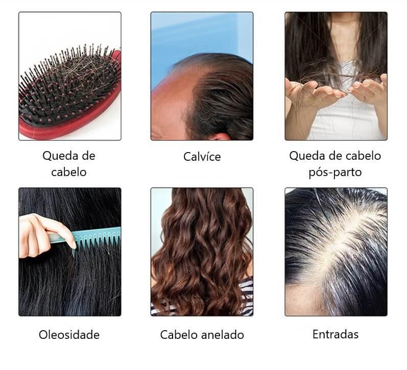 Escova a Laser – Terapia para Crescimento Capilar HairRise - Lojas Promorin