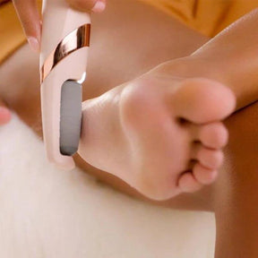 Lixa Elétrica Removevedora de Calos e Rachaduras SoftFeet™ + 2 Rolos Extra e Limpador de Brinde - Lojas Promorin